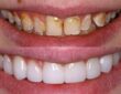 Cosmetic dentistry