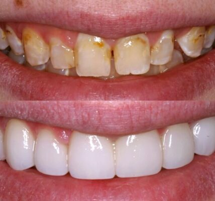 Cosmetic dentistry