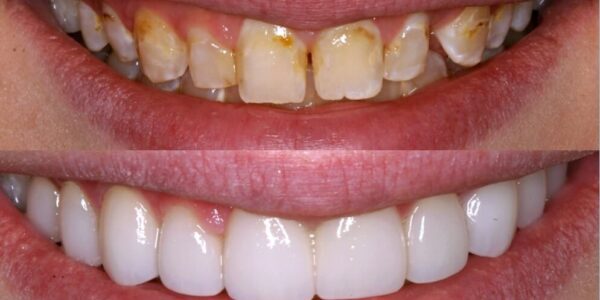 Cosmetic dentistry